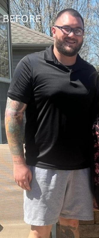 Weight Loss Before