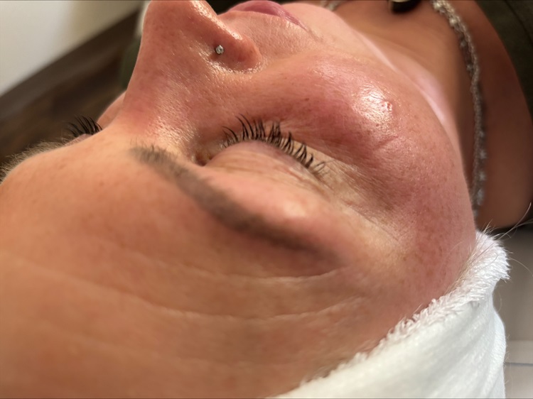 Lash Lift & Tint - After